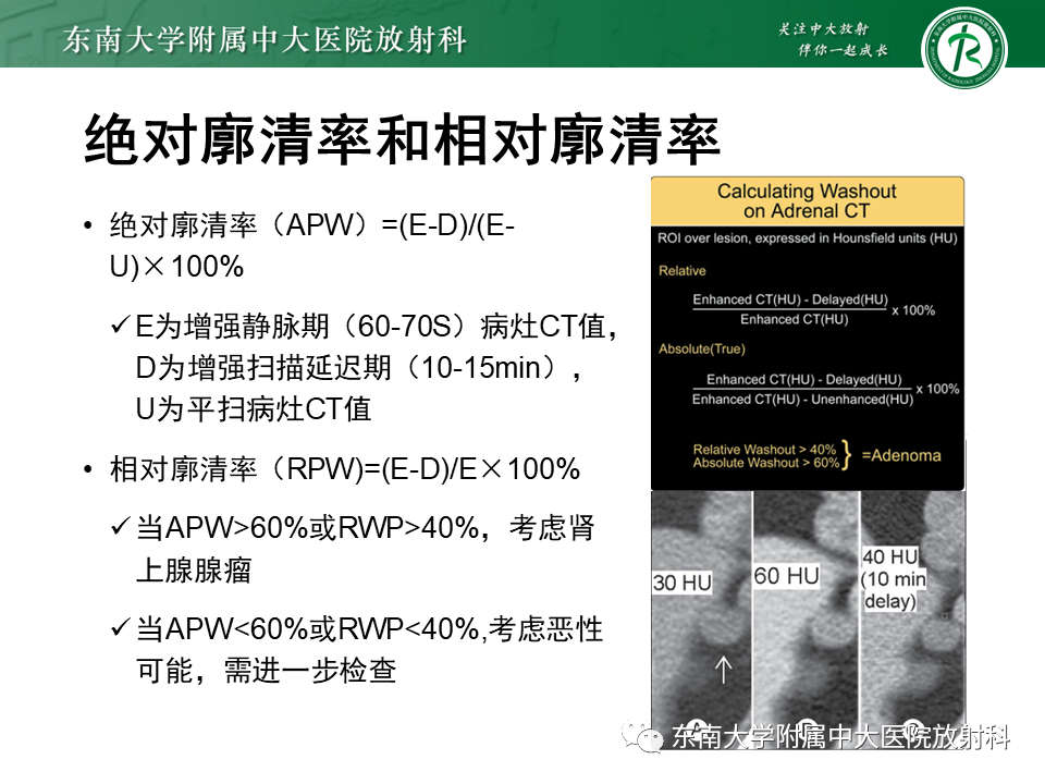 影像PPT - 【PPT】肾上腺嗜铬细胞瘤的影像诊断-19 影像PPT - 【PPT】肾上腺嗜铬细胞瘤的影像诊断-19