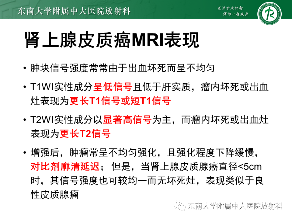 影像PPT - 【PPT】肾上腺嗜铬细胞瘤的影像诊断-23 影像PPT - 【PPT】肾上腺嗜铬细胞瘤的影像诊断-23