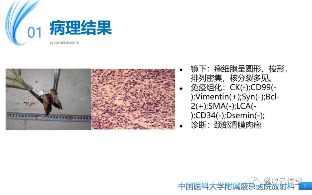 影像PPT - 【PPT】滑膜肉瘤-8
