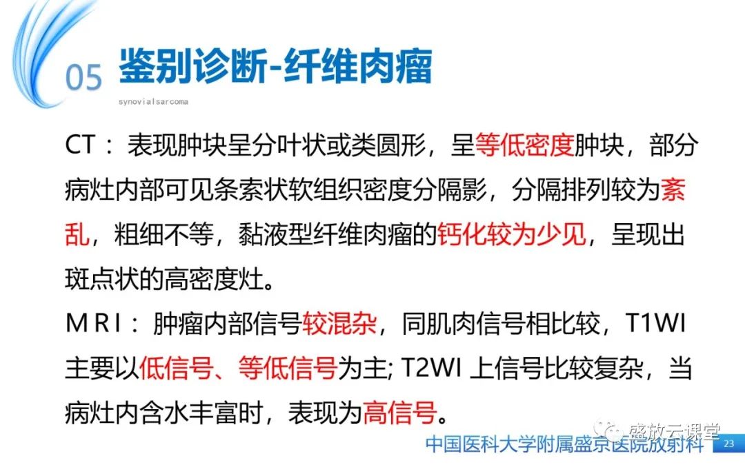 影像PPT - 【PPT】滑膜肉瘤-22
