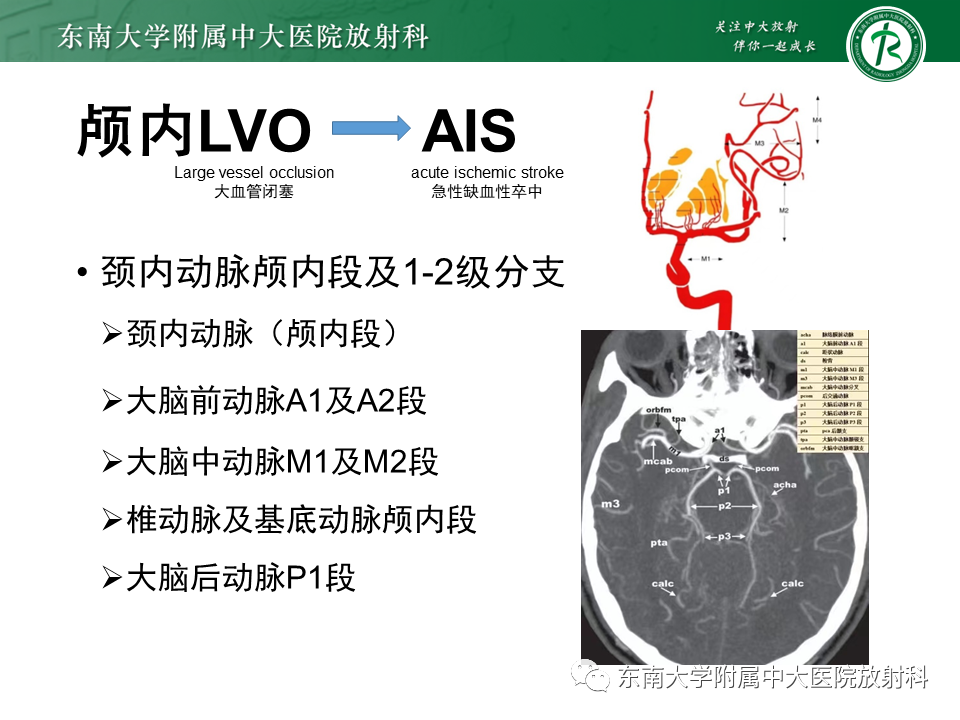 影像PPT - 【PPT】急性缺血性脑卒中的多模态CT评估-12