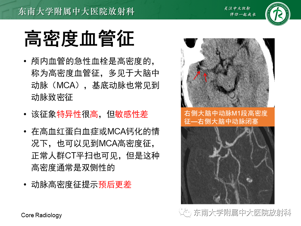 影像PPT - 【PPT】急性缺血性脑卒中的多模态CT评估-22