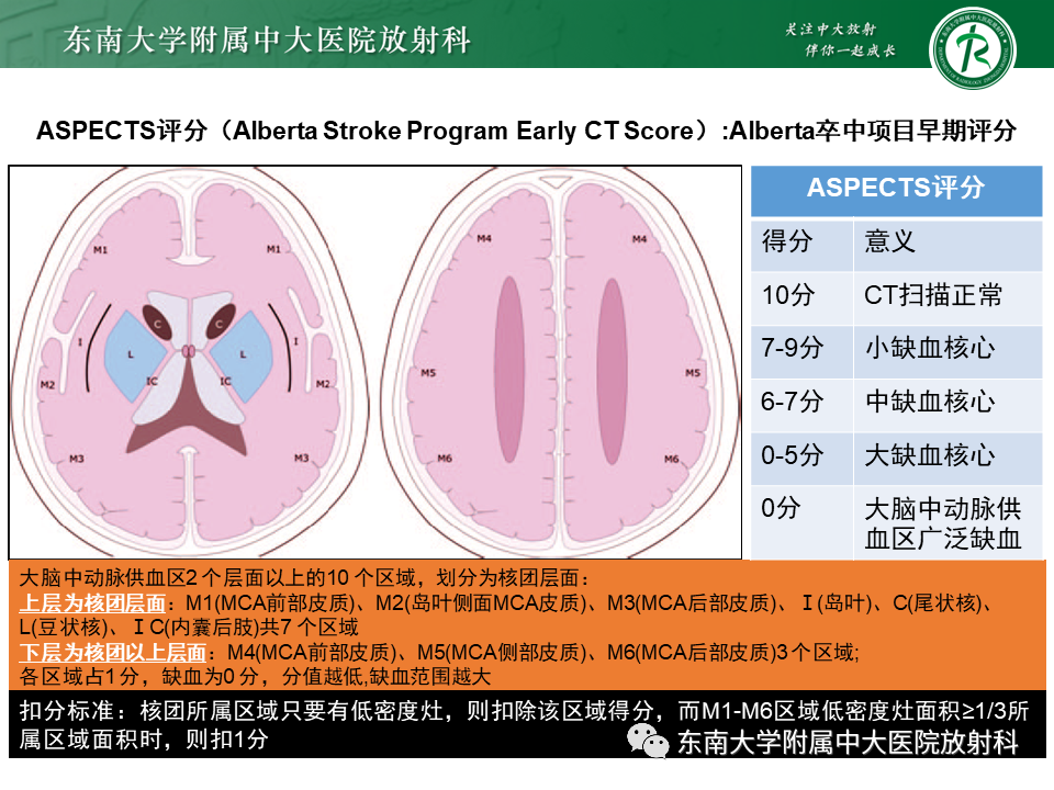 影像PPT - 【PPT】急性缺血性脑卒中的多模态CT评估-28