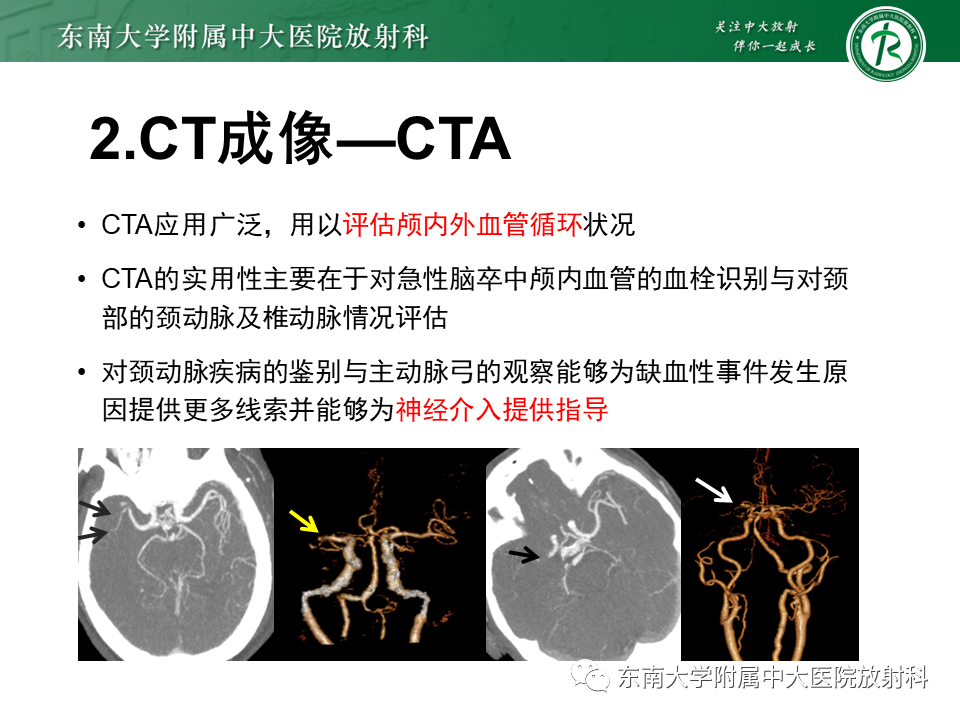 影像PPT - 【PPT】急性缺血性脑卒中的多模态CT评估-30