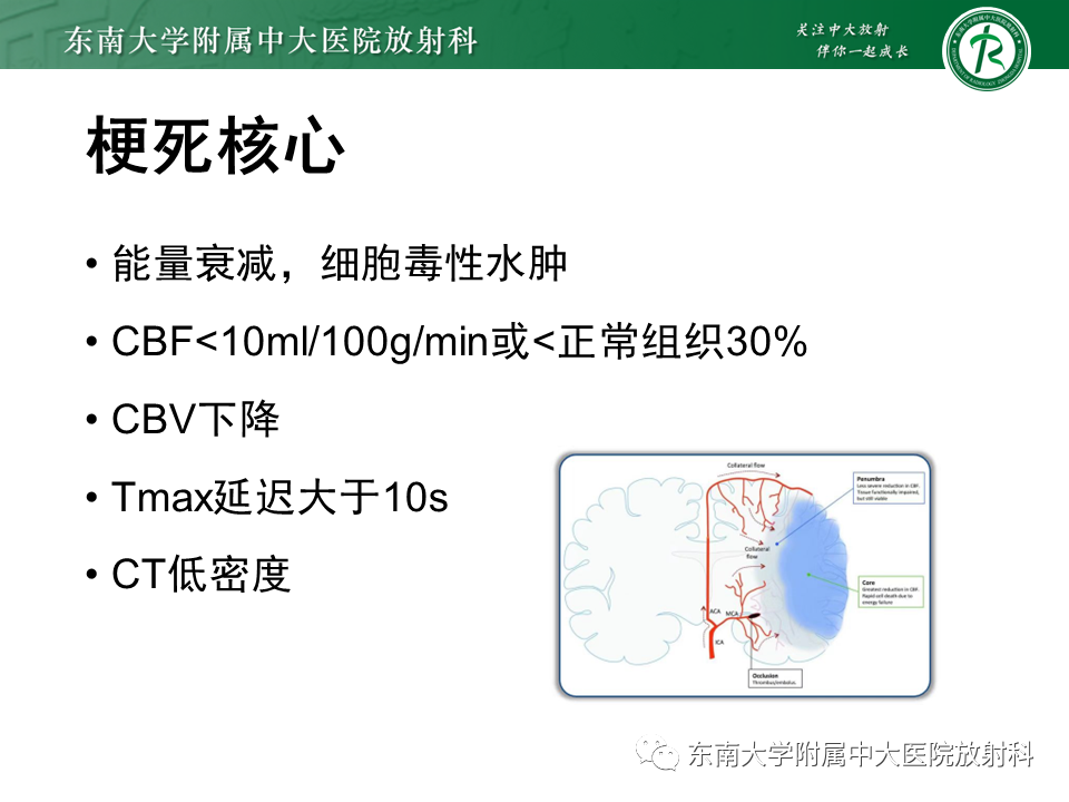 影像PPT - 【PPT】急性缺血性脑卒中的多模态CT评估-37