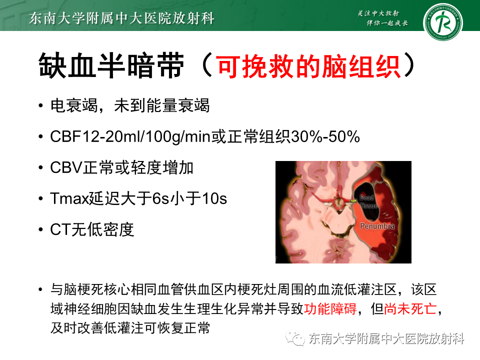 影像PPT - 【PPT】急性缺血性脑卒中的多模态CT评估-38