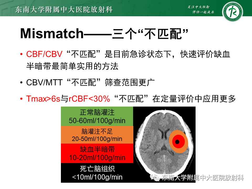 影像PPT - 【PPT】急性缺血性脑卒中的多模态CT评估-39
