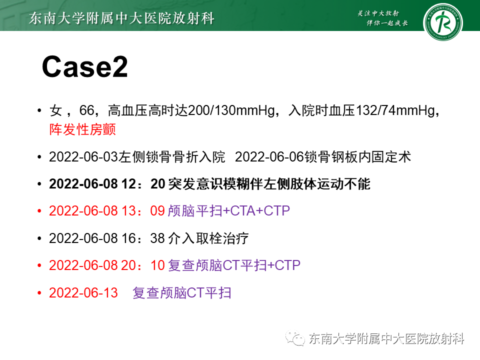 影像PPT - 【PPT】急性缺血性脑卒中的多模态CT评估-53