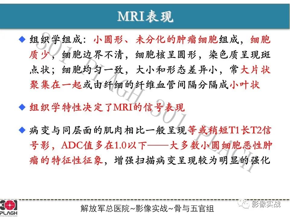 影像PPT - 【病例】股骨尤文氏肉瘤/PNET一例-16