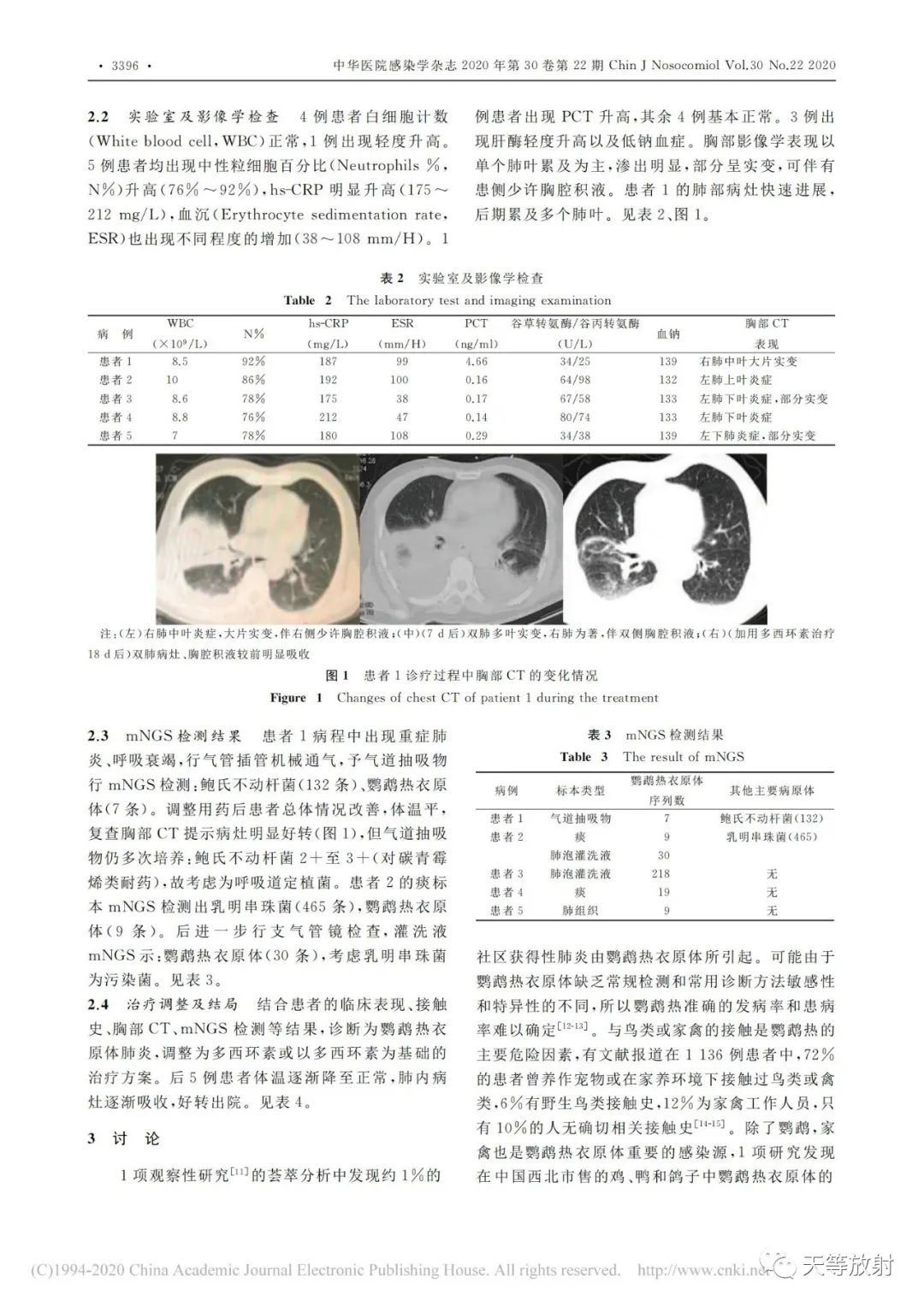 影像PPT - 【病例】鹦鹉热衣原体肺炎1例CT影像-17 影像PPT - 【病例】鹦鹉热衣原体肺炎1例CT影像-17