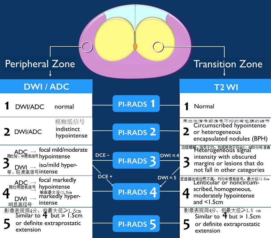 影像PPT - 前列腺癌-PI-RADS V2-1 影像PPT - 前列腺癌-PI-RADS V2-1