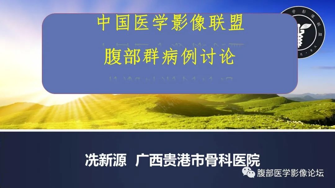 影像PPT - 【病例】肝细胞肝癌1例CT及MR-1