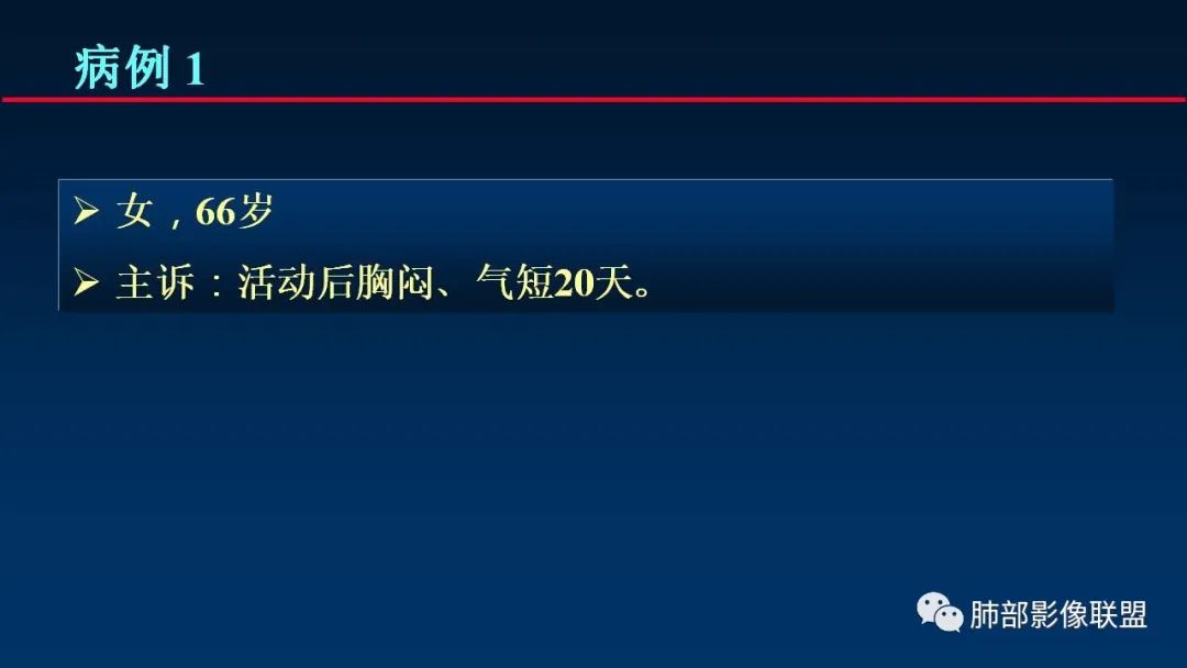 影像PPT - 【PPT】肺梗死的影像解析-2 影像PPT - 【PPT】肺梗死的影像解析-2