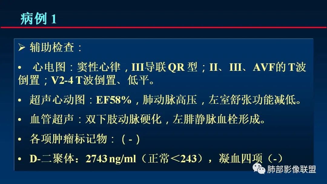 影像PPT - 【PPT】肺梗死的影像解析-4 影像PPT - 【PPT】肺梗死的影像解析-4