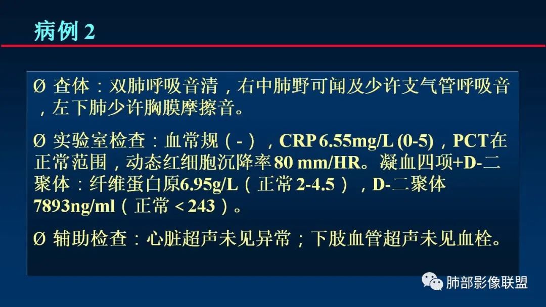 影像PPT - 【PPT】肺梗死的影像解析-9 影像PPT - 【PPT】肺梗死的影像解析-9