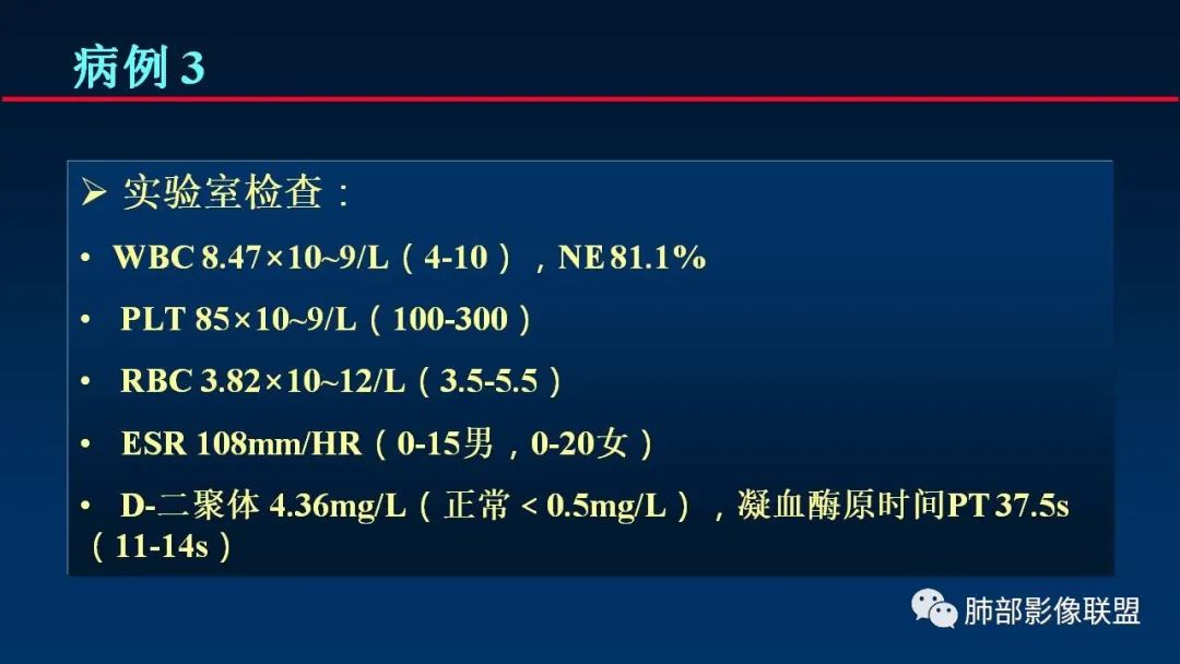 影像PPT - 【PPT】肺梗死的影像解析-15 影像PPT - 【PPT】肺梗死的影像解析-15