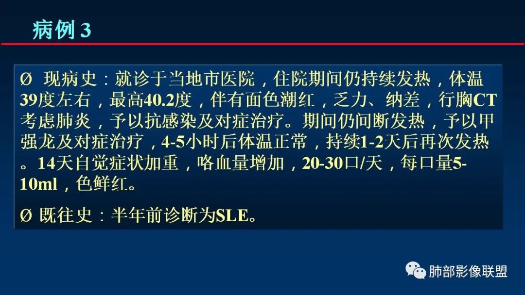 影像PPT - 【PPT】肺梗死的影像解析-14 影像PPT - 【PPT】肺梗死的影像解析-14