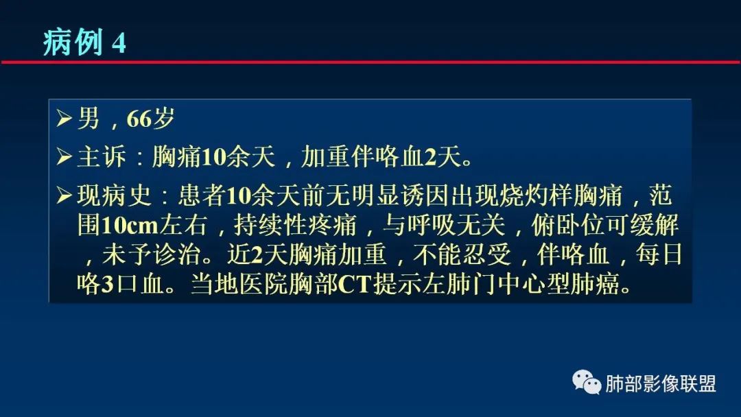 影像PPT - 【PPT】肺梗死的影像解析-19 影像PPT - 【PPT】肺梗死的影像解析-19