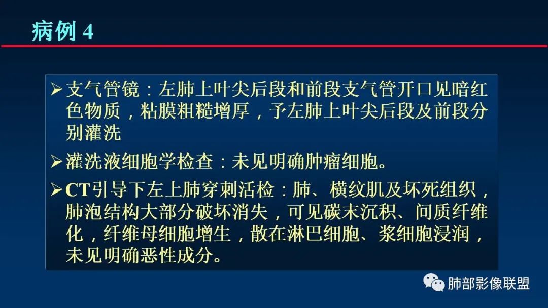 影像PPT - 【PPT】肺梗死的影像解析-22 影像PPT - 【PPT】肺梗死的影像解析-22