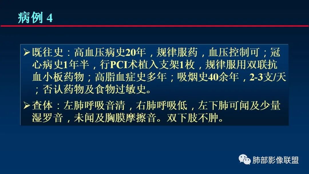 影像PPT - 【PPT】肺梗死的影像解析-20 影像PPT - 【PPT】肺梗死的影像解析-20