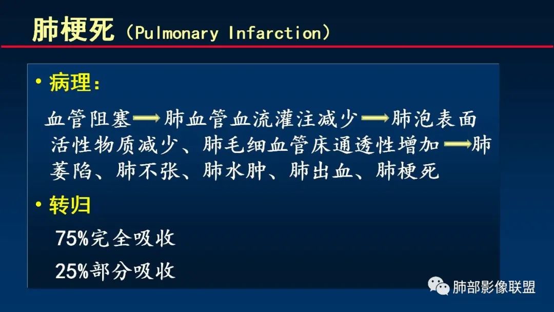 影像PPT - 【PPT】肺梗死的影像解析-30 影像PPT - 【PPT】肺梗死的影像解析-30