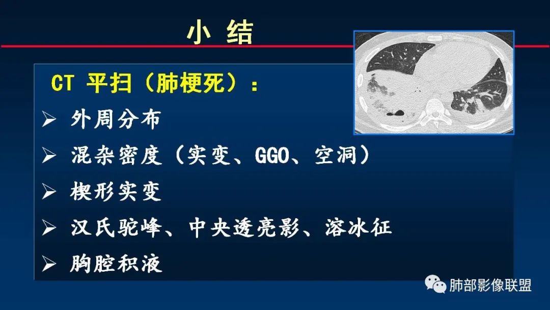 影像PPT - 【PPT】肺梗死的影像解析-40 影像PPT - 【PPT】肺梗死的影像解析-40