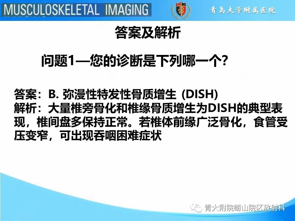 影像PPT - 【PPT】弥漫性特发性骨肥厚-4
