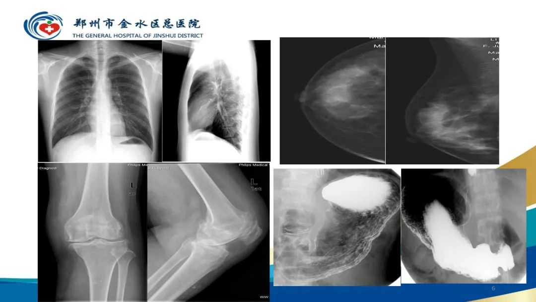 影像PPT - 【PPT】如何选择合适的影像学检查-6