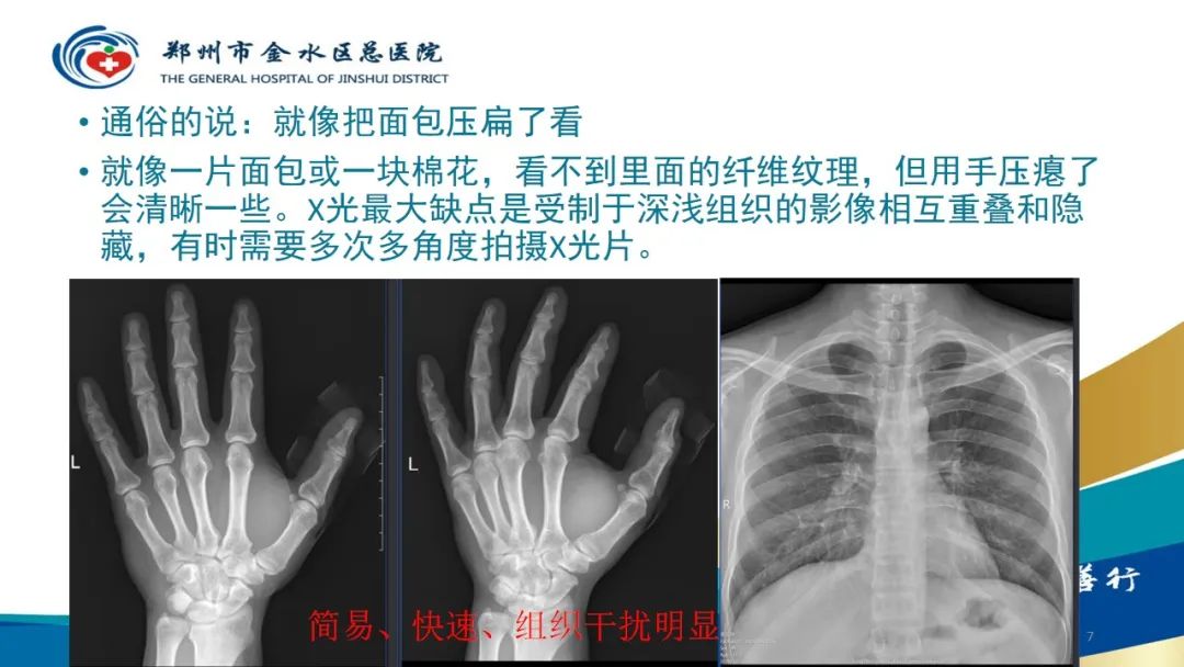 影像PPT - 【PPT】如何选择合适的影像学检查-7