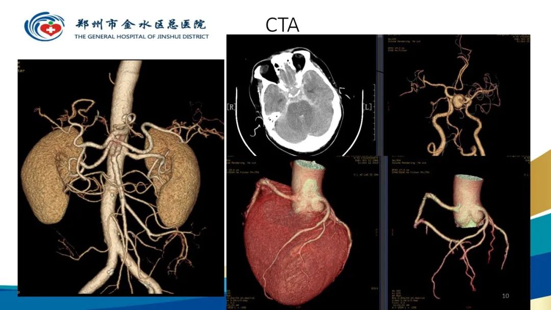 影像PPT - 【PPT】如何选择合适的影像学检查-10
