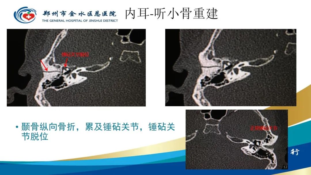 影像PPT - 【PPT】如何选择合适的影像学检查-12