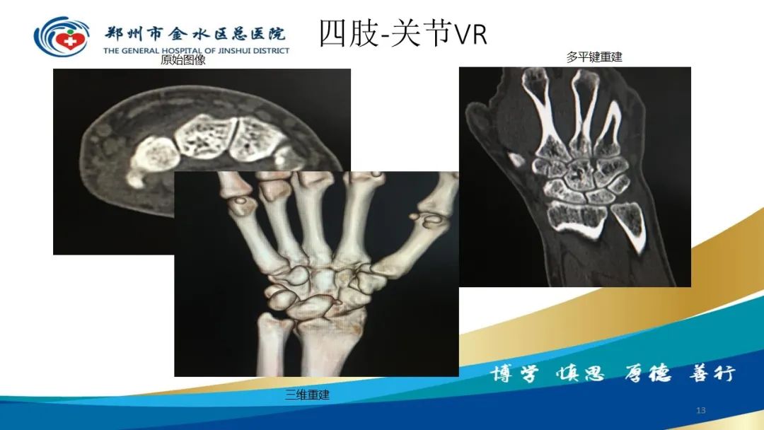 影像PPT - 【PPT】如何选择合适的影像学检查-13