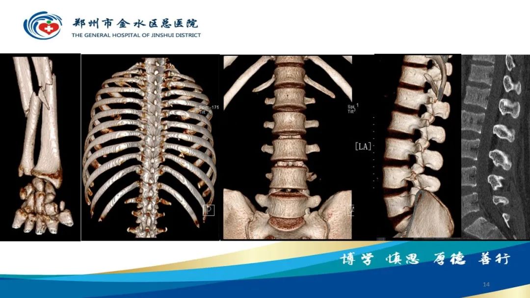 影像PPT - 【PPT】如何选择合适的影像学检查-14