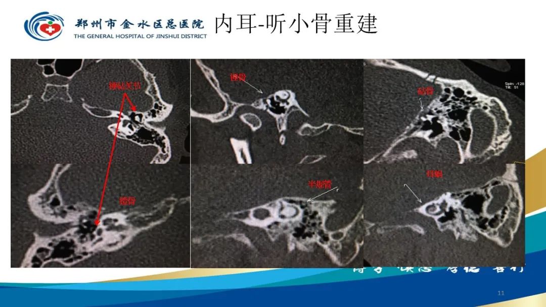 影像PPT - 【PPT】如何选择合适的影像学检查-11