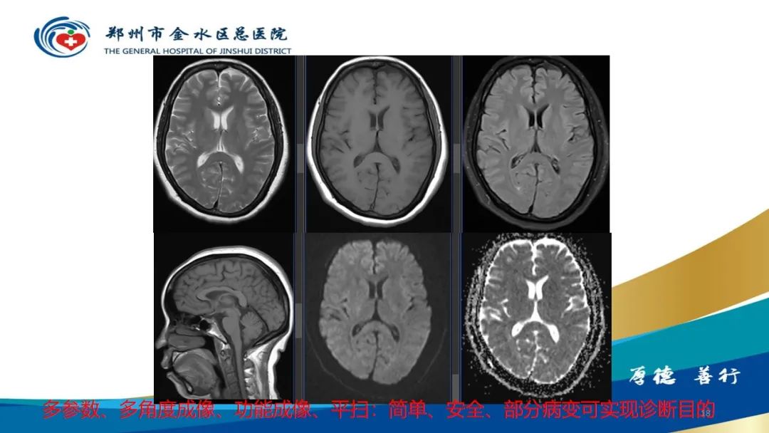 影像PPT - 【PPT】如何选择合适的影像学检查-18