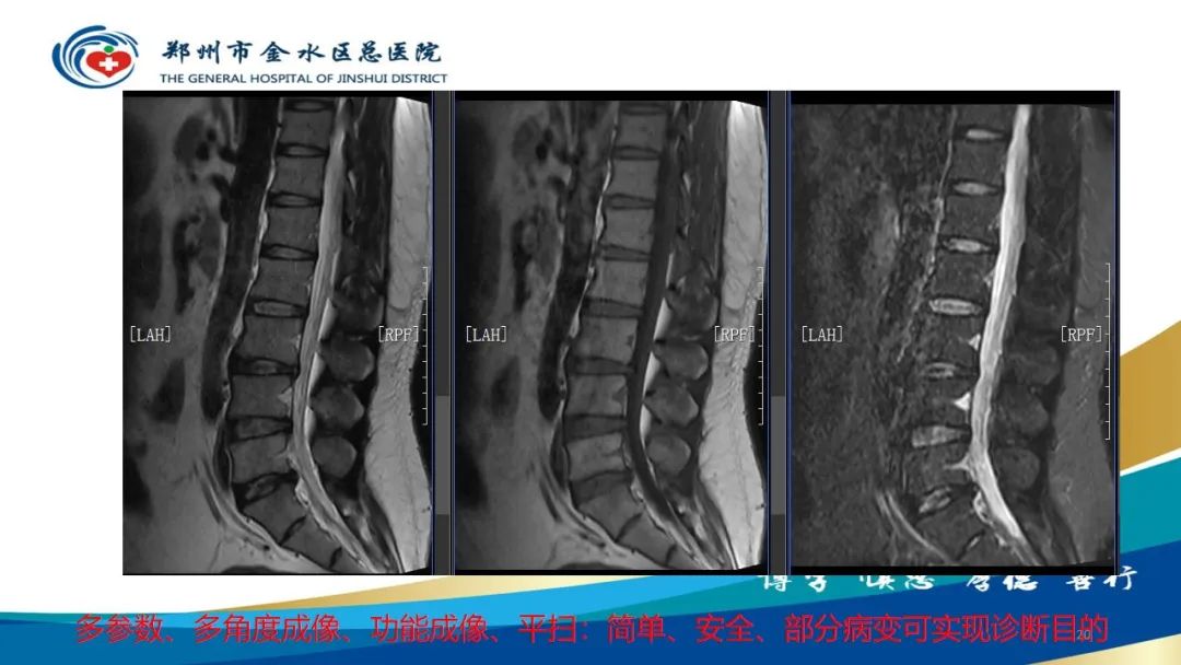 影像PPT - 【PPT】如何选择合适的影像学检查-20