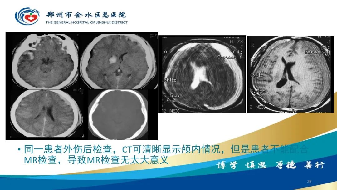 影像PPT - 【PPT】如何选择合适的影像学检查-28