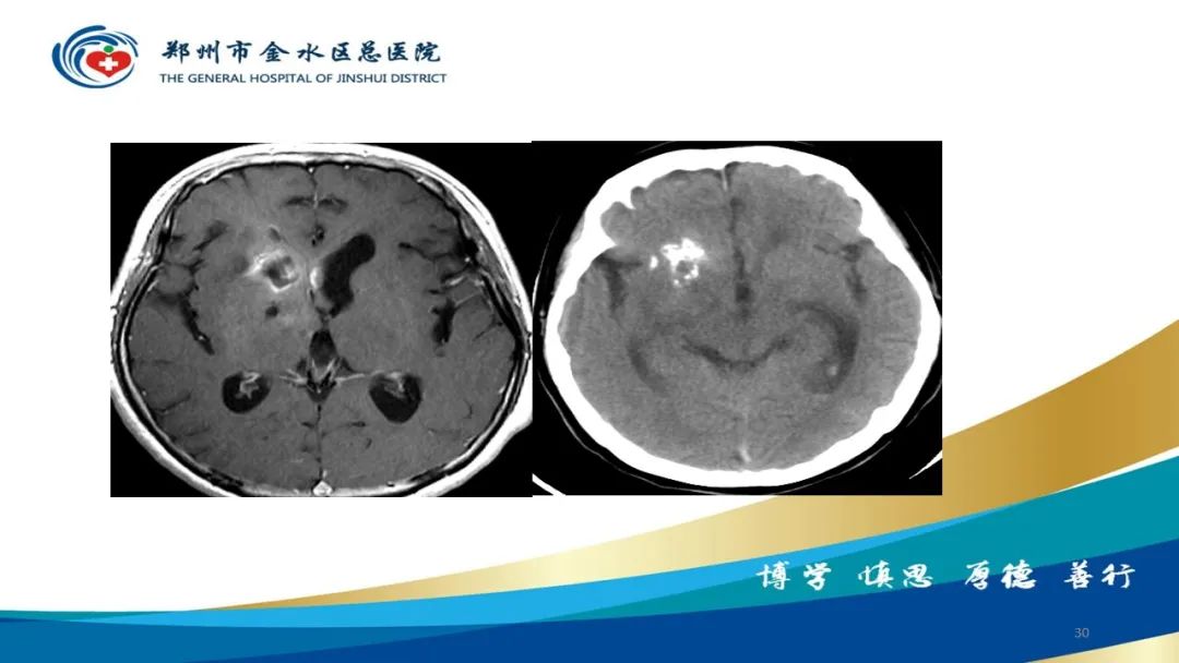 影像PPT - 【PPT】如何选择合适的影像学检查-30