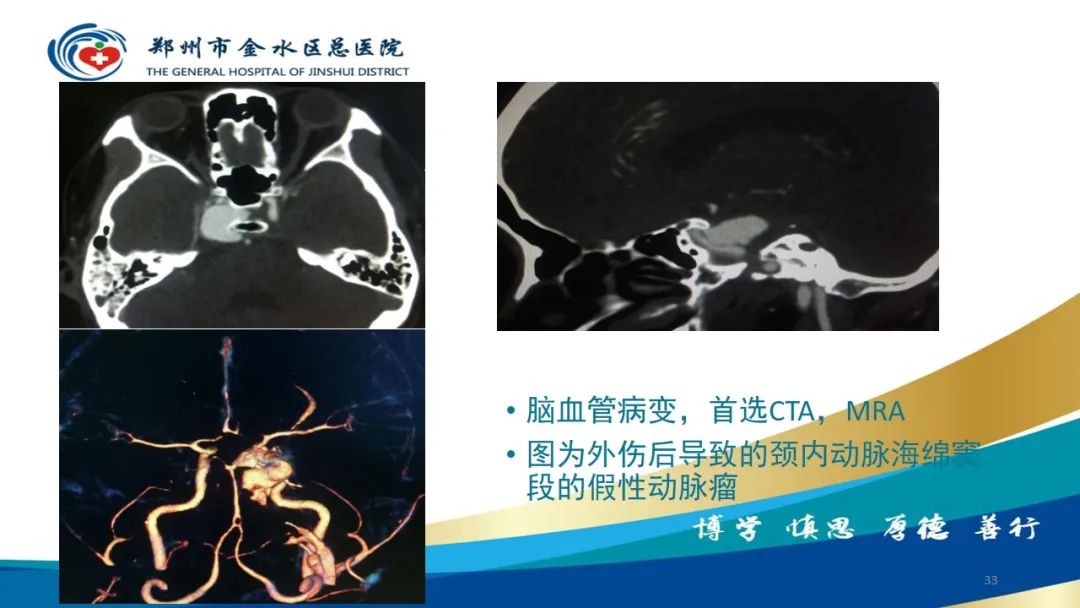 影像PPT - 【PPT】如何选择合适的影像学检查-33