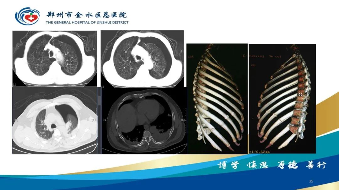 影像PPT - 【PPT】如何选择合适的影像学检查-35