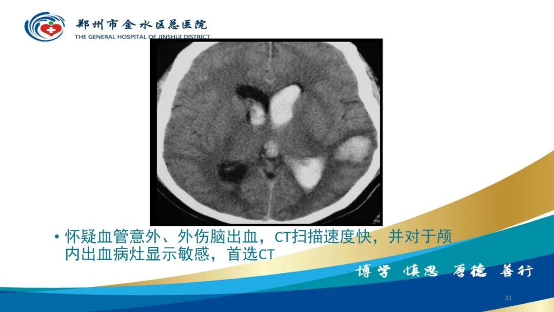 影像PPT - 【PPT】如何选择合适的影像学检查-31