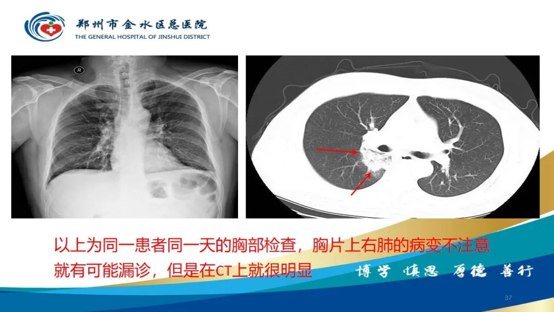 影像PPT - 【PPT】如何选择合适的影像学检查-37