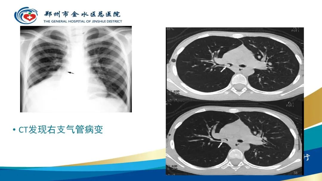 影像PPT - 【PPT】如何选择合适的影像学检查-38