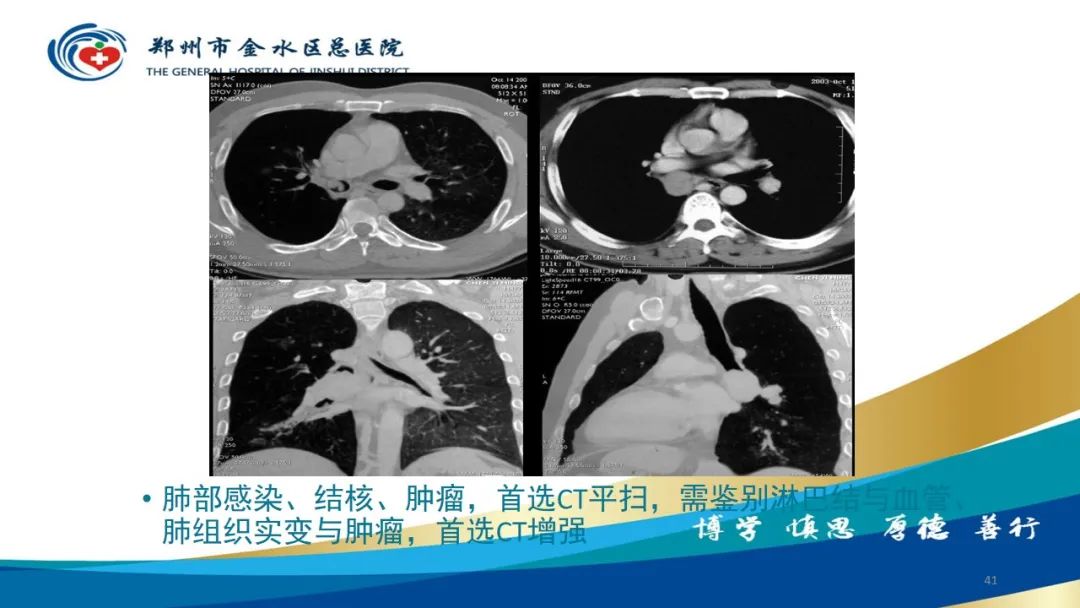 影像PPT - 【PPT】如何选择合适的影像学检查-41