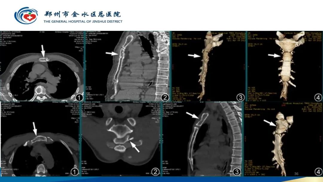 影像PPT - 【PPT】如何选择合适的影像学检查-36