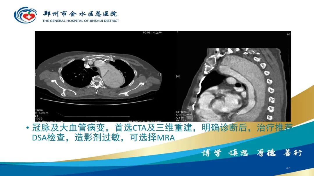 影像PPT - 【PPT】如何选择合适的影像学检查-42