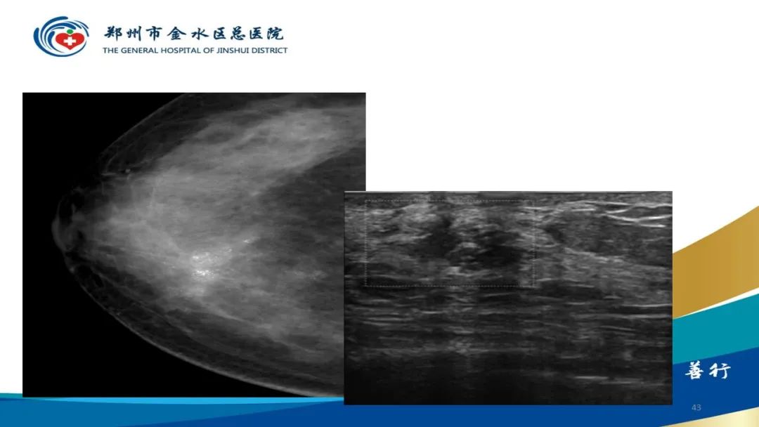 影像PPT - 【PPT】如何选择合适的影像学检查-43