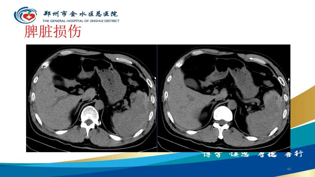 影像PPT - 【PPT】如何选择合适的影像学检查-46