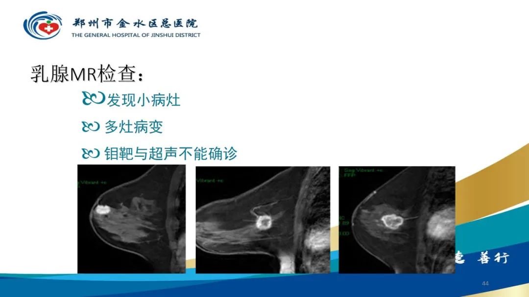 影像PPT - 【PPT】如何选择合适的影像学检查-44