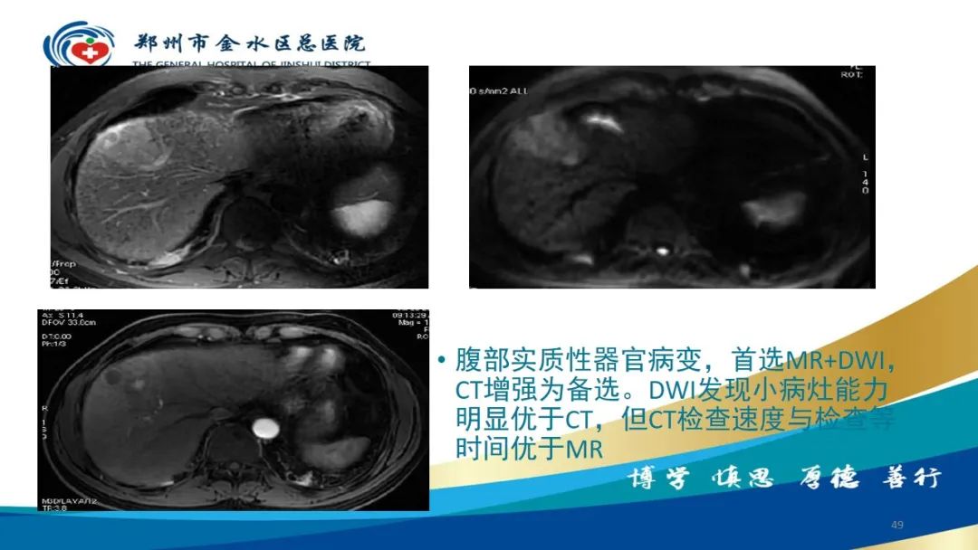 影像PPT - 【PPT】如何选择合适的影像学检查-49